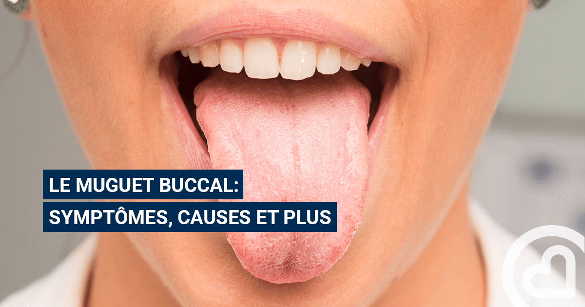 Muguet Buccal Candidose Buccale Familiprix Muguet Buccal Candidose Buccale Familiprix
