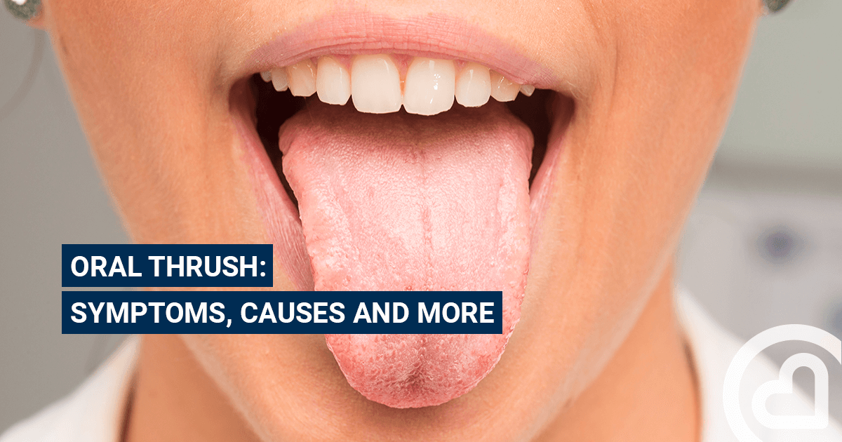 Oral thrush Familiprix