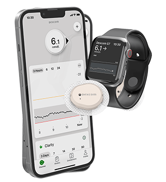 Les systèmes de surveillance continue du glucose (SCG) Dexcom